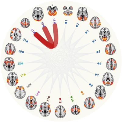 Leisure Activities and Their Relationship With MRI Measures of Brain Structure, Functional Connectivity, and Cognition in the UK Biobank Cohort